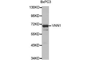 Western blot analysis of extracts of various cell lines, using VNN1 antibody. (VNN1 Antikörper  (AA 300-415))