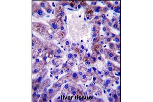 UBE2W Antibody (C-term) (ABIN657530 and ABIN2846549) immunohistochemistry analysis in formalin fixed and paraffin embedded human liver tissue followed by peroxidase conjugation of the secondary antibody and DAB staining. (UBE2W Antikörper  (C-Term))