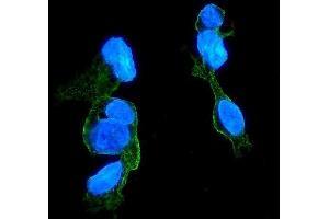IF analysis of CCR2 using anti-CCR2 antibody (ABIN7598970). (CCR2 Antikörper  (AA 1-125))