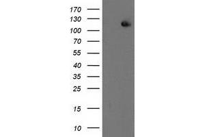 Western Blotting (WB) image for anti-Excision Repair Cross-Complementing Rodent Repair Deficiency, Complementation Group 4 (ERCC4) antibody (ABIN1498070) (ERCC4 Antikörper)