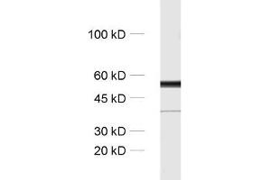 dilution: 1 : 1000, sample: rat brain homogenate (TUBB3 Antikörper)