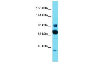 Host: Rabbit Target Name: CCDC178 Sample Type: HT1080 Whole Cell lysates Antibody Dilution: 1. (CCDC178 Antikörper  (C-Term))