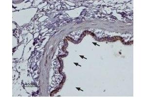 Expression of α2B-Adrenoreceptor in rat lungImmunohistochemical staining of rat lung paraffin embedded sections using Anti-α2B-Adrenergic Receptor (extracellular) Antibody (ABIN7042900, ABIN7043920 and ABIN7043921), (1:100).