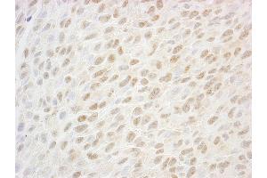Immunohistochemistry (IHC) image for anti-SSB1 (AA 161-211) antibody (ABIN7448816) (SSB1 (AA 161-211) Antikörper)