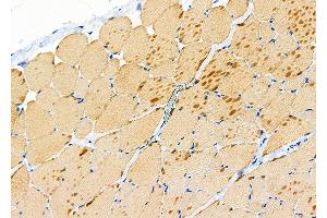 ABIN6265467 and ABIN6272743 at 1/100 staining Rat skin tissue by IHC-P.