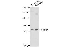 Western blot analysis of extracts of various cell lines, using MYCT1 antibody (ABIN6293947) at 1:3000 dilution.