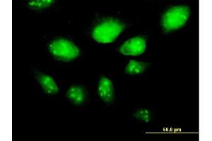 Immunofluorescence of purified MaxPab antibody to HSPA2 on HeLa cell. (HSPA2 Antikörper  (AA 1-639))