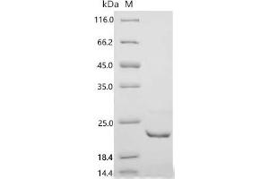 Prolactin-Induced Protein (PIP) (AA 29-146), (full length) protein (His tag)