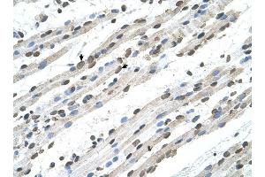 RCE1 antibody was used for immunohistochemistry at a concentration of 4-8 ug/ml to stain Skeletal muscle cells (arrows) in Human Muscle.