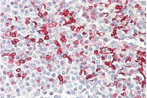 ABIN5539536 (5µg/ml) staining of paraffin embedded Human Spleen. (HMBS Antikörper  (AA 160-173))