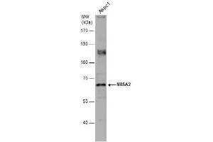 WB Image Whole cell extract (30 μg) was separated by 7. (NR5A2 + LRH1 Antikörper)