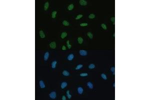 Immunofluorescence analysis of U-2 OS cells using MKL1 Polyclonal Antibody  at dilution of 1:100 (40x lens). (MKL1 Antikörper  (AA 1-280))