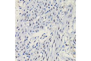 Immunohistochemistry of paraffin-embedded mouse uterus using Progesterone Receptor Rabbit pAb (ABIN6128570, ABIN6145518, ABIN6145519 and ABIN6213802) at dilution of 1:100 (40x lens). (Progesterone Receptor Antikörper  (AA 1-250))