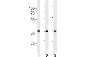 UCH37 antibody western blot analysis in 293, HeLa, 293T lysate. (UCHL5 Antikörper)