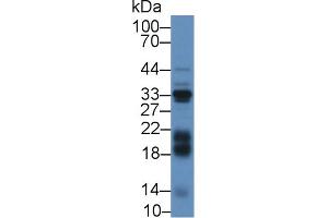 Western blot analysis of Mouse Liver lysate, using Cow IGFBP3 Antibody (2 µg/ml) and HRP-conjugated Goat Anti-Rabbit antibody ( (IGFBP3 Antikörper  (AA 106-241))