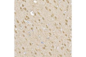 Immunohistochemistry (IHC) image for anti-Suppressor of Cytokine Signaling 1 (SOCS1) (AA 1-211) antibody (ABIN6148263)