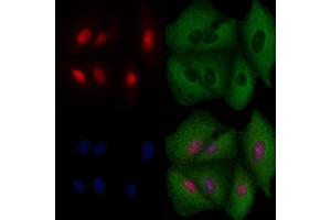 ABIN6256973 and ABIN6274518 staining  cells by IF/ICC.