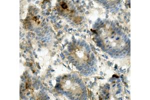 IHC analysis of ANPEP using anti-ANPEP antibody (ABIN7600087).