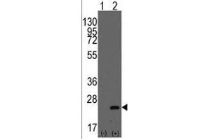 Western blot analysis of BarX1(arrow) using rabbit polyclonal BarX1 Antibody (C-term) . (BARX1 Antikörper  (Middle Region))