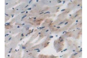 Immunohistochemistry (IHC) image for anti-Dihydrolipoamide Dehydrogenase (DLD) antibody (ABIN7442078)