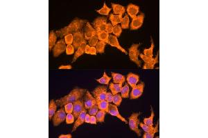 Immunofluorescence analysis of HeLa cells using RPL23 antibody (ABIN1682575, ABIN5664722, ABIN5664724 and ABIN6220574) at dilution of 1:100. (RPL23 Antikörper  (AA 1-140))