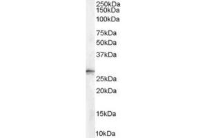 Image no. 2 for anti-Stratifin (SFN) (Internal Region), (N-Term) antibody (ABIN374638) (14-3-3 sigma/SFN Antikörper  (Internal Region, N-Term))