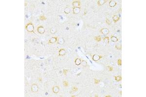 Immunohistochemistry of paraffin-embedded rat brain using Casp8 antibody (ABIN5997368) at dilution of 1/100 (40x lens). (Caspase 8 Antikörper)