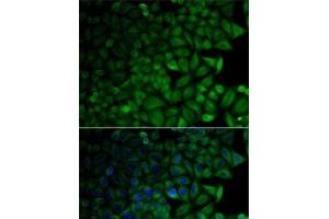 Immunofluorescence analysis of HeLa cells using CD1D Polyclonal Antibody (CD1d Antikörper)
