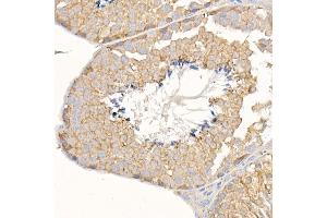 Immunohistochemistry of paraffin-embedded mouse testis using KRAS Rabbit pAb (ABIN3021676, ABIN3021677, ABIN3021678, ABIN1513137 and ABIN1514282) at dilution of 1:150 (40x lens). (K-RAS Antikörper)