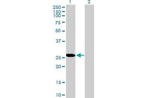 Western Blot analysis of RBPMS expression in transfected 293T cell line by RBPMS MaxPab polyclonal antibody. (RBPMS Antikörper  (AA 1-219))