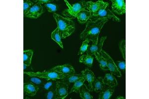 IF analysis of EPLIN/LIMA1 using anti-EPLIN/LIMA1 antibody (ABIN7602639). (LIMA1 Antikörper  (AA 9-744))