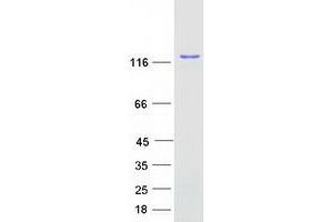 Western Blotting (WB) image for Squamous Cell Carcinoma Antigen Recognized By T Cells 3 (SART3) protein (Myc-DYKDDDDK Tag) (ABIN2731408)