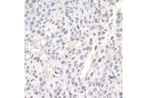 Immunohistochemistry (IHC) image for anti-Zinc Finger E-Box Binding Homeobox 1 (ZEB1) (AA 1074-1124) antibody (ABIN7448887) (ZEB1 Antikörper  (AA 1074-1124))