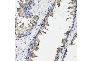 Immunohistochemistry of paraffin-embedded human prostate using OTC antibody at dilution of 1:100 (x40 lens). (OTC Antikörper)