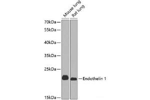 Western blot analysis of extracts of various cell lines using Endothelin 1 Polyclonal Antibody at dilution of 1:1000.