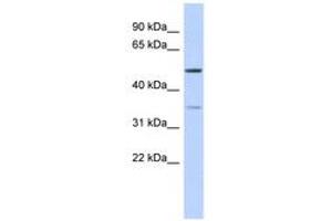Image no. 1 for anti-Cholesteryl Ester Transfer Protein (CETP) (AA 395-444) antibody (ABIN6743589) (CETP Antikörper  (AA 395-444))