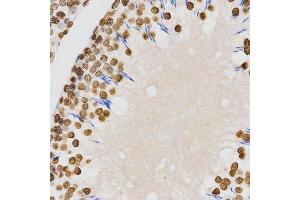 Immunohistochemistry (Paraffin-embedded Sections) (IHC (p)) image for anti-Histone H4 (2meLys20) antibody (ABIN3016048)