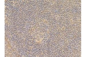 ABIN7095684 and ABIN7099746 at 1/100 staining human normal tonsil tissue by IHC-P. (KLHL26 Antikörper)