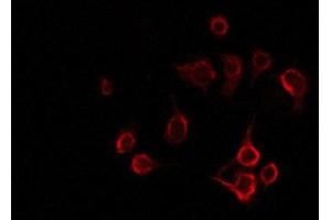 ABIN6277830 staining NIH-3T3 by IF/ICC. (LAT Antikörper  (Internal Region))