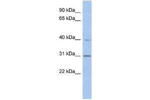 WB Suggested Anti-PERLD1 Antibody Titration:  0. (PGAP3 Antikörper  (N-Term))