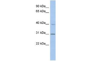 WB Suggested Anti-PERLD1 Antibody Titration:  0.