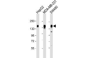 All lanes : Anti-C Antibody (C-term) at 1:2000 dilution Lane 1: HepG2 whole cell lysate Lane 2: MDA-MB-231 whole cell lysate Lane 3: S whole cell lysate Lysates/proteins at 20 μg per lane. (CD130/gp130 Antikörper  (C-Term))