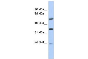 MGC34821 antibody used at 1 ug/ml to detect target protein. (MGC34821 (Middle Region) Antikörper)