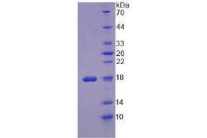 SDS-PAGE analysis of Human Ribonuclease A Protein. (RNASE1 Protein)