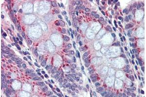Human Colon: Formalin-Fixed, Paraffin-Embedded (FFPE) (BACE2 Antikörper  (C-Term))