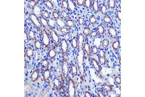 Immunohistochemistry of paraffin-embedded Mouse kidney using LETMD1 Rabbit pAb (ABIN3023040, ABIN3023041, ABIN3023042, ABIN1513151 and ABIN6219360) at dilution of 1:100 (40x lens). (LETMD1 Antikörper  (AA 161-360))