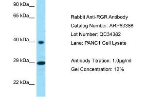Western Blotting (WB) image for anti-Retinal G Protein Coupled Receptor (RGR) (C-Term) antibody (ABIN971566) (RGR Antikörper  (C-Term))