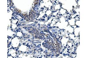 IHC analysis of Adam28 using anti-Adam28 antibody (ABIN7600945). (ADAM28 Antikörper  (AA 26-195))