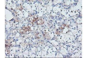 Immunohistochemistry (IHC) image for anti-serpin Peptidase Inhibitor, Clade E (Nexin, Plasminogen Activator Inhibitor Type 1), Member 2 (SERPINE2) antibody (ABIN2731830)