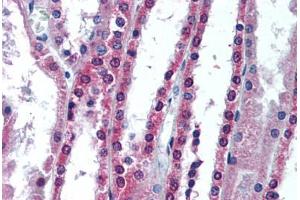 Human Kidney (formalin-fixed, paraffin-embedded) stained with APIP antibody ABIN292116 at 10 ug/ml followed by biotinylated goat anti-rabbit IgG secondary antibody ABIN481713, alkaline phosphatase-streptavidin and chromogen. (APIP Antikörper)
